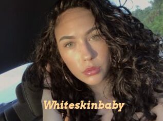 Whiteskinbaby